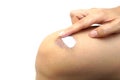 Applying a white cream to cure bruise on knee