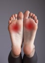 Arch pain, inflammation, overuse, plantar fascia injury. Foot with red points