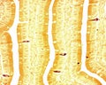 Argyrophilic cells in intestinal epithelium