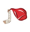 Arm in a cast and red bag Royalty Free Stock Photo