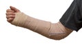 Arm splint Royalty Free Stock Photo