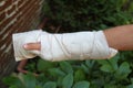 Arm wrapped up in a bandage