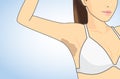 Armpit skin discoloration Royalty Free Stock Photo