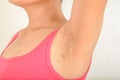 Hairy armpits and Black spots Royalty Free Stock Photo