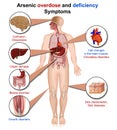 Arsenic deficiency and overdose 3d medical vector illustration isolated on white background