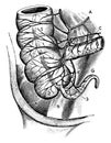 Arterial Blood Supply of the Cecum and Appendix, vintage illustration