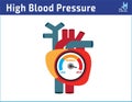 Arterial high blood pressure checking concept.vector illustration flat icon cartoon design