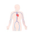 Arterial line catheter placed in the radial artery of man