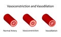 Arterial vasoconstriction and vasodilation. Scientific Diagram. Vector illustration.