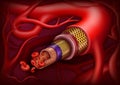 Artery structure. Vector ilustration Royalty Free Stock Photo