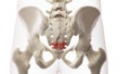 An arthritic coccyx