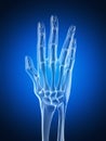 Arthritic hand Royalty Free Stock Photo