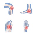 Arthritis icons set cartoon vector. Human joint with pain ring