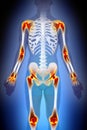 Arthritis Joints Pain Anatomy Male concept Royalty Free Stock Photo