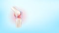 Arthritis knee joint and cartilage osteoarthritis side on blue background with copy space for text. Bone human skeleton anatomy of