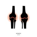 Arthritis and Knee Joint Icon Royalty Free Stock Photo