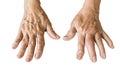Arthritis of old woman`s hand Royalty Free Stock Photo