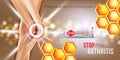 Arthritis Pain Relief Ointment Ads. Vector 3d Illustration With Tube Cream With Honey Extract.
