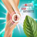 Arthritis Pain Relief Ointment ads. Vector 3d Illustration with Tube cream with peppermint extract. Royalty Free Stock Photo