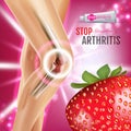 Arthritis Pain Relief Ointment ads. Vector 3d Illustration with Tube cream with strawberry extract.