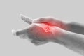 Arthritis of thumb joint. Royalty Free Stock Photo