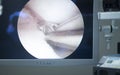 Arthroscopy surgery screen