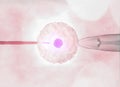 Artificial or assisted fertilization is the process by which the union of gametes is artificially carried out, by microscope