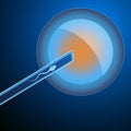 Artificial insemination. The fertilized egg, washed, injected sperm, uterus, womb, syringe. In vitro fertilisation. Artificial