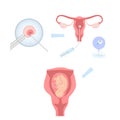 Artificial insemination illustration, process infographics. Vector illustration