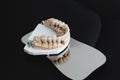 Artificial jaw with zirconium crowns, stands on a surgical mirror in a dental office. Dentistry and treatment concept