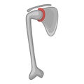 Artificial joint icon, cartoon style