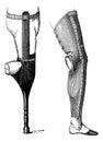 Artificial Legs for Below-knee Amputation, vintage engraving