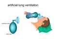 Artificial lung ventilation Royalty Free Stock Photo