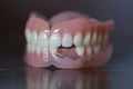 Medical denture on table, shallow focus