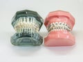 Artificial model of human jaw with wire colorful braces attached Royalty Free Stock Photo