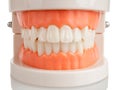 Artificial model of jaws with teeth, foreground, bite of teeth, correct orthognathic bite, orthodontic treatment, an example Royalty Free Stock Photo