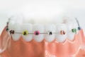 Artificial teeth model with braces Royalty Free Stock Photo
