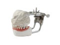 Artificial tooth, dental prosthesis with false silver tooth, metalic crown on tooth.