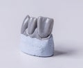 Artificial tooth