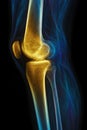 Artistic Rendering of Golden Human Knee Joint, X-ray Royalty Free Stock Photo