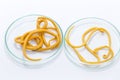 Ascariasis is a disease caused by the parasitic roundworm Ascaris lumbricoides for education. Royalty Free Stock Photo