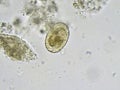 Ascaris lumbricoides