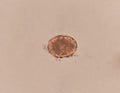 Ascaris lumbricoides egg in stool exam. Royalty Free Stock Photo