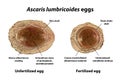 Ascaris lumbricoides eggs, illustration