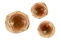 Ascaris lumbricoides fertilized egg, illustration