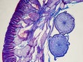 Ascaris megalocephala cross section under the microscope showing its cuticle, mesodermal cells, pseudoceloma and ovaries - optical Royalty Free Stock Photo