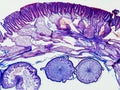 Ascaris megalocephala cross section under the microscope showing its cuticle, mesodermal cells, pseudoceloma and ovaries - optical Royalty Free Stock Photo