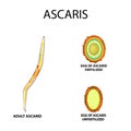 Ascaris the structure of an adult. Fertilized and unfertilized egg. The structure of the egg ascarids. Set. Infographics.