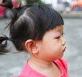 Asian baby girl eye swell Royalty Free Stock Photo
