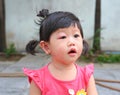 Asian baby girl eye swell Royalty Free Stock Photo